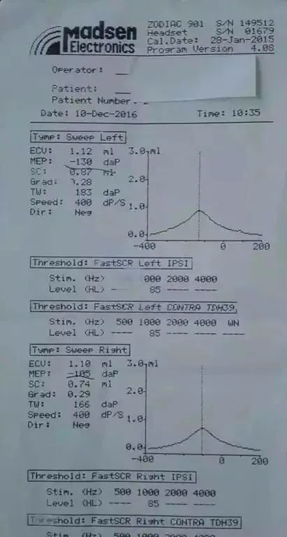 佑三案例腺样体肥大和中耳炎